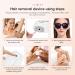 IPL Hair Remover Mini Home Laser - 500,000 Flashes, 5 Energy Gears - Body Face Bikini Area - Portable Lightweight - Gifts for Women and Men (White) - Buy Online on GoSupps.com