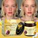Bee Venom Comprehensive Cream Bee Venom Skin Treatment Cream All-in-One Lifting & Firming Anti-Aging Moisturizing Effectively reduces all types of skin blemishes 1 - Buy Online on GoSupps.com