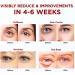 Under Eye Patches 10Pairs Red Ginseng Eye Masks For Puffy Eyes Dark Circles Treatment Under Eye Bags Remover Anti Wrinkle Patches Nourishing Repairing Moisturizing Under Eye Mask Korean Skincare - Buy Online on GoSupps.com