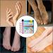 Ingrown Toenail Patch Ingrown Toenail Corrector | Toenail Repair to Relieve Nail Groove Nail Correction Patches Suitable for Men Women and Elderly Adern - Buy Online on GoSupps.com