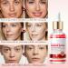 Dragon Blood Face Serum - Anti Wrinkle Face Serum for Women - Dark Spot Remover for Face - Anti Aging Face Care Serum - Dark Spot Correcting Glow Serum 30ml - Buy Online on GoSupps.com