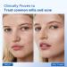 Milia Remover treatment with Salicylic Acid: Milia Spot Removal Milia Acne Serum for Eyes and Face for Men and Women 30 ML 0.99 Fl Oz (Pack of 1) - Buy Online on GoSupps.com