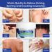 Extra Strength Antifungal Cream for Jock Itch & Itchy Skin Relief - Ringworm & Athlete's Foot Treatment - 3.4 oz - Buy Online on GoSupps.com
