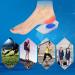 Best Heel Cushion Cups for Plantar Fasciitis | Pain Relief Insoles - International Shipping - Buy Online on GoSupps.com