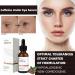 Caffeine & Hyaluronic Acid Under Eye Serum Caffeine Eye Serum Under Eye Cream for Dark Circles and Puffy Eyes Eye Serum for Dark Circles Eye Cream Anti Aging Firming Eye Cream Under Eye Treatment - Buy Online on GoSupps.com