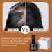 Root Touch Up Hair Powder Root Cover Up Hairline Shadow Powder for Thinning Hair Hairline Powder Hair Root Dye Instantly Hair Color Shadow Cover Gray Hair Root Thin Hair Powder(Dark Brown) 01 - Buy Online on GoSupps.com