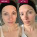 SKINICIAN Advanced Pro-Radiance Enzyme Peel - Peel Off Face Mask for Brighter Looking Skin - AHA Beauty Facial Mask - Anti-Ageing Fruit Enzyme Peel - Vegan & Cruelty Free (50ml) - Buy Online on GoSupps.com