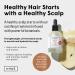 Buy dpHUE ACV Daily Scalp Serum - Soothe Dry Scalps & Promote Healthy Hair Growth - 1.7 fl oz - Hyaluronic Acid Formula - International Shipping Available - Buy Online on GoSupps.com