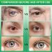 Optivipro Presbyopia Eye Drops | Vision Recovery & Dry Eye Relief | Comprehensive Eye Care (10pcs x 0.7ml) - International Shipping Available - Buy Online on GoSupps.com