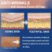 Akissos Forehead Wrinkle Patches - Non-Invasive Smoothers for Forehead Wrinkles - 5cm*5m Roll - Buy Online on GoSupps.com