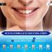 Celakeety Teeth Whitening Stripes - Effective Home Bleaching Strips for Whiter Teeth | Remove Stains & Achieve a Bright Smile - Buy Online on GoSupps.com