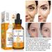 20% Vitamin C Serum for Face with Hyaluronic Acid - Anti-Aging Facial Serum for Men & Women Fades Dark Spots Boosts Collagen Hydrates & Plumps Skin - 1 Fl Oz - Buy Online on GoSupps.com