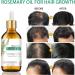 Rosemary Oil for Hair Hair Regrowth Serum Relieve Dry Damaged Hair to Target Hair Loss Rosemary Hair Serum for Hair Rapid Growth and Thickening Trengthen Hair Roots - Buy Online on GoSupps.com