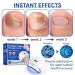 Furzero Purenail Laser Therapy Device - Effective Nail Fungus Treatment Light Therapy Solution for Healthy Nails - Buy Online on GoSupps.com