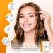 Dark Spot Remover for Face - Korean Glow Serum with Niacinamide & Acid for Acne Melasma & Freckles | 1.6 Fl Oz - Buy Online on GoSupps.com