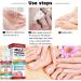 Fungal Nail Treatment Nail Fungus Treatment for Toenail Ingrown Toenail Treatment Toe Nail Fungal Treatment Fungal Nail Treatment for Toenails Extra Strong Nail Repair Treatment Repairing Broken Nail - Buy Online on GoSupps.com