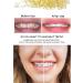 Orthodontic Elastic Bands - 500 Pack of Dental Latex Elastics for Tooth Gap Accessories (Fuchs 1/4) - International Shipping Available - Buy Online on GoSupps.com