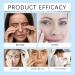 Retinol Roller Eye Serum with Vitamin C Under Eye Roller Essence Eye Essence for Dark Circles Eye Cream for Puffy Eyes Anti-Wrinkle Roller Eye Cream with Retinol for Hydration Brightness - Buy Online on GoSupps.com