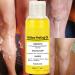 Super Strength Yellow Peeling Oil for Dark Skin - 30/50ml Exfoliating Lightening Treatment - Extra Strength for All Skin Types - Buy Online on GoSupps.com