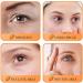 Hydrating Eye Cream for Dark Circles and Puffy Eyes Carrot Natural Ingredients Moisturiser Brighten Tightener Under Eye Repair Cream Eye Bags Remover Wrinkle Filler Eye Serum for All Skin Types(20g) - Buy Online on GoSupps.com
