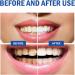 SP-8 Probiotic Toothpaste - Ultra Whitening & Brightening Teeth Whitening Kit with Toothbrush (2) - Shop Internationally - Buy Online on GoSupps.com