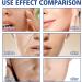 Gla-Mory Micros-Infusions System for Face Gla-Mory Micro-Infusions System for Lips Hyaluronic Acid Serum for Face Micros-Infusions Facial System with Serum Hydrating Face Serum for Women 10ml - Buy Online on GoSupps.com