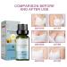 Natural Essential Oil for Breast Enlargement - Herbal Bust Lifting Serum (1PC) | Anti-Sagging Formula - Buy Online on GoSupps.com