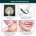 Sunartec Ultrasonic Electric Toothbrush - Advanced 360 Sonic Teeth Whitening Kit for Adults | Portable U-V Cleaning, Air-Drying Charger, IPX7 Waterproof - Buy Online on GoSupps.com