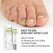 Efero 2PCs Nail Treatment Repair Gel Set - Nail Repair Cream & Essence for Healthy, Beautiful Nails - Toe and Toenail Care Solution - Buy Online on GoSupps.com