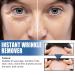 2PCS Retinol Anti-Aging Face Cream 5 Seconds Instant Anti Wrinkle Face Cream for Tightening and Firming Retinol Face Moisturizer Reduces Wrinkles Fine Lines for Women and Men - Buy Online on GoSupps.com