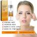 New Zealand Bee Venom and Manuka Honey Serum Manuka Honey Serum for Face Honey Facial Serum Honey Anti-Aging Serum Anti-Aging Serum Honey Face Serum (3Pcs) - Buy Online on GoSupps.com