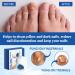 Fivfivgo Light Therapy Device for Nail Fungus Revolutionary Nail Fungus Treatment Device Portable Cold Laser Therapy Device for Cleaning and Care of Nails - Buy Online on GoSupps.com