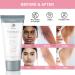 Natural Skin Bleaching Cream for Black Skin | Intimate Lightening for Body, Face & Private Parts | Brightening Dark Skin with Niacinamide & Arbutin - Buy Online on GoSupps.com