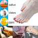96 Self Adhesive Foam Callus Toe Pads for Foot & Heel Pain Relief - Pinky+Nude - Buy Online on GoSupps.com