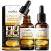SADOER Ginger Hair Growth Serum and Anti-Hair Loss Treatment Essence for Men and Women - Plant Extract Oil (2)