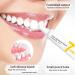 Liacsy 7 Day Active Gum Treatment - Antibacterial Gel for Clean Gums & Stain Removal | International Shipping - Buy Online on GoSupps.com