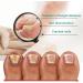 Ingrown Toenail Treatment Ingrowing Toenail Treatment Nail Growth Treatment Natural Ingrown Toenail Correction Nail Treatments Trimming Toenail Softening Drops Toe Nail Fungal Treatment(10ml) - Buy Online on GoSupps.com
