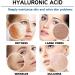 Hyaluronic Acid Microneedling Serum - Hyaluronic Acid Face Serum - Gla-Mory Micro-Infusion Facial System - Hyaluronic Acid Serum for Face - Dark Spot Remover for Face - Face Serum for Women - Buy Online on GoSupps.com