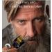 Nikka Notto QMD Derma Roller for Hair Growth & Beard Growth - 0.25mm Facial Skin Care for Women & Men - Banish Scars, Dermaroller Gold - Buy Online on GoSupps.com