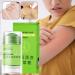 Extra Powerful Anti-Itch Cream Soothing Lotion Extra Powerful - Natural Care 35g Calming Face Body Hands Feet Moisturizing Ointment - Buy Online on GoSupps.com