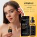 Derma Roller Kit for Face and Body - Vitamin C 20% Serum Skin Care Kit 540 Microneedling Face Roller 0.5mm Vitamin C E Hyaluronic Acid Serum Microneedle Roller Set for Acne Scar Anti Aging Wrinkles 2 Piece Set - Buy Online on GoSupps.com
