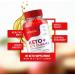 ActivLife Keto ACV Gummies - 1000mg Apple Cider Vinegar Gummies for Weight Loss (2 Pack - 120 Gummies) - Shop Internationally - Buy Online on GoSupps.com