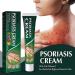 Zdiwond Psoriasis & Eczema Soothing Ointment - Natural Chinese Herbal Healing Cream for Dry Skin (2PCS) - Buy Online on GoSupps.com