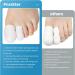 20 PCs Gel Toe Protection Caps - Pain Relief for Blisters Ingrown Toenails & Friction - Silicone Toe Plaster (4PCS Large 16PCS Medium) - White - Buy Online on GoSupps.com