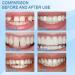 Tooth Solid Gel Temporary Repair Kit | Denture Adhesive for Fake Teeth & Gaps | One Size - Buy Online on GoSupps.com