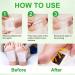 20Pcs Ginger Detox Foot Pads | Natural Bamboo Vinegar Formula | Relieve Stress, Improve Sleep | Deep Cleansing and Dampness Removal - Buy Online on GoSupps.com