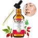 Rosehip Oil Organic Cold Pressed Oil 100% Pure 60ml Rosehip Oil Skin Hair Nail Face Oil Body Oil Vegan Rose Seed Oil - Buy Online on GoSupps.com