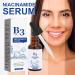 Vitamin C Serum for Face Dark Spots Corrector Nicotinamide Anti Aging Face Serum Smoothing Face Serum Anti Wrinkles & Deep Hydrating Face Serums For Mature Skin - Buy Online on GoSupps.com