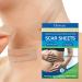 8 Pack Scar Away Silicone Scar Sheets - Breathable & Reusable Silicone Scar Tape - Buy Online on GoSupps.com