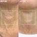 Wrinkles Schminkles Neck & Chest Patch Set - Hyaluronic Silicone Smoothing Pads for Wrinkles Stretch Marks and Cleavage Care | Reusable & Hypoallergenic - Buy Online on GoSupps.com